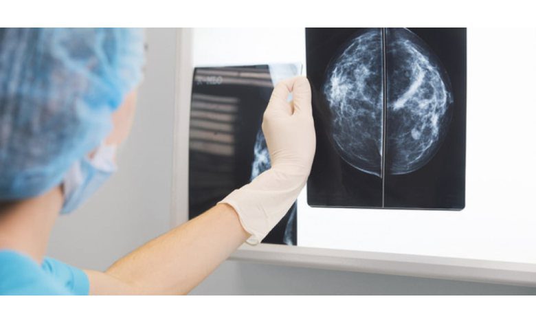 Breast tumors, Humanitas masterclass in Catania with European experts